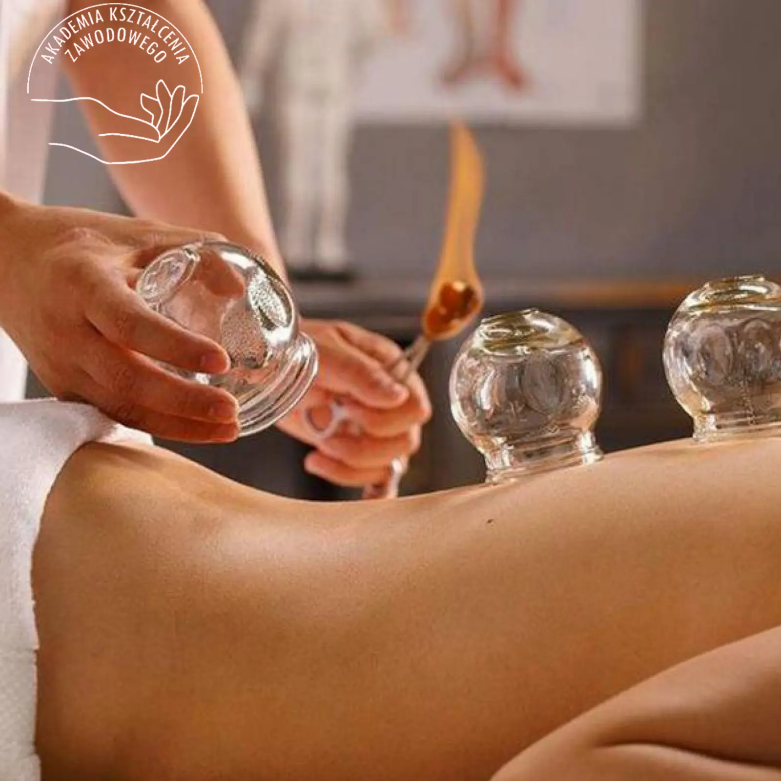 Kurs stawiania baniek ogniowych Akademia Kształcenia Zawodowego