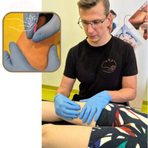 Kurs Suchego Igłowania i Punktów Spustowych (11-12.04.2026)